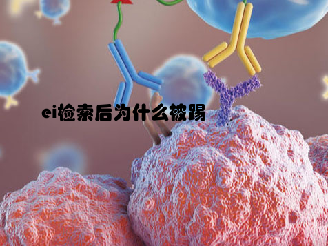 ei检索后为什么被踢